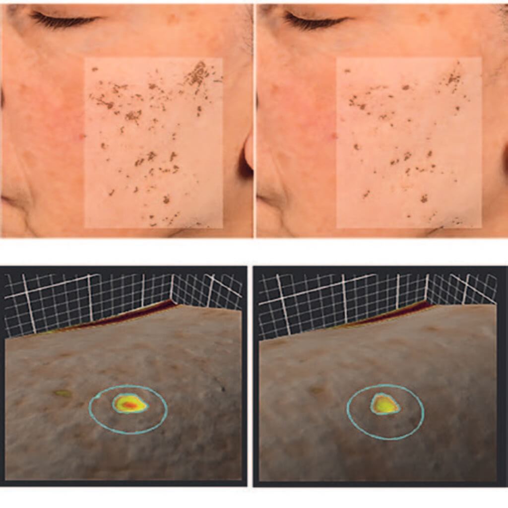 EURO COSMETICS Magazine • How to stop the skin from ageing faster than it should • Euro Cosmetics • Euro Cosmetics
