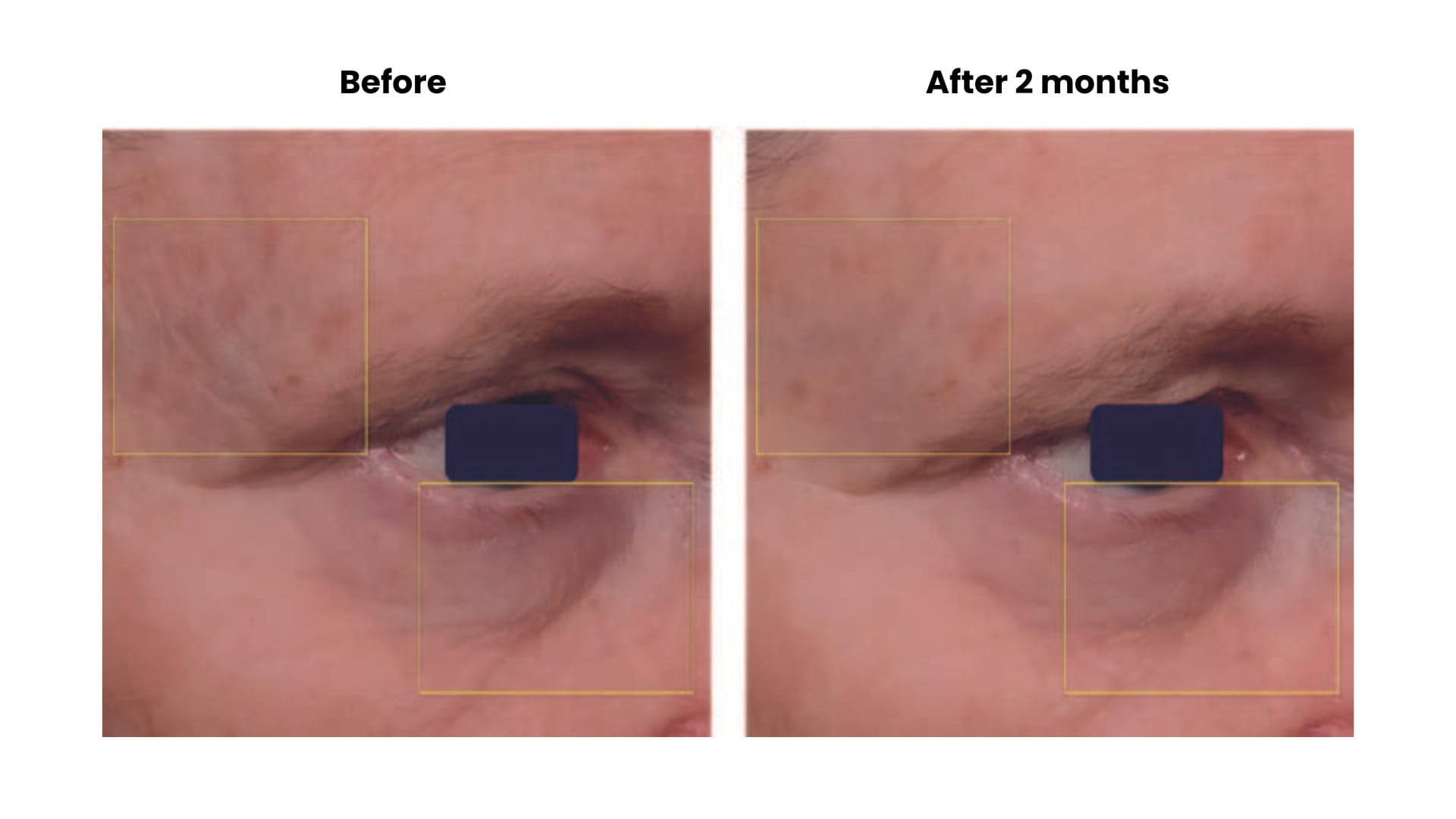 EURO COSMETICS Magazine • How to stop the skin from ageing faster than it should • Euro Cosmetics • Euro Cosmetics