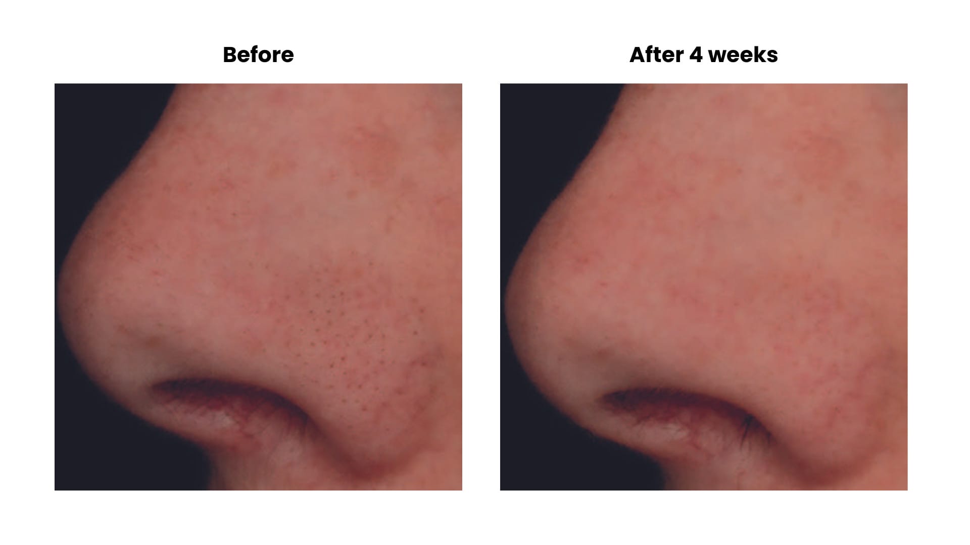 EURO COSMETICS Magazine • How to stop the skin from ageing faster than it should • Euro Cosmetics • Euro Cosmetics